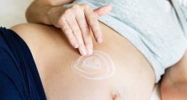 Is There Any Help For Stretch Marks After a Baby?