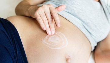 Is There Any Help For Stretch Marks After a Baby?