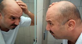 All Your Questions About Scalp Micropigmentation (SMP) Answered